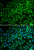 Immunofluorescence analysis of HeLa cells using SMARCA5 Polyclonal Antibody