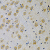 Immunohistochemistry of paraffin-embedded Rat brain using IGFBP4 Polyclonal Antibody at dilution of  1:100 (40x lens).