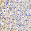 Immunohistochemistry of paraffin-embedded Human liver damage using CBLB Polyclonal Antibody at dilution of  1:200 (40x lens).
