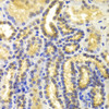 Immunohistochemistry of paraffin-embedded Human kidney using EIF5A Polyclonal Antibody at dilution of  1:100 (40x lens).