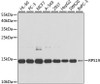 Western blot analysis of extracts of various cell lines using RPS19 Polyclonal Antibody at dilution of 1:1000.