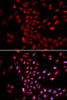 Immunofluorescence analysis of U2OS cells using KPNA4 Polyclonal Antibody