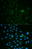 Immunofluorescence analysis of MCF-7 cells using CD79B Polyclonal Antibody