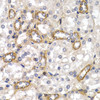 Immunohistochemistry of paraffin-embedded Rat kidney using CD83 Polyclonal Antibody at dilution of  1:200 (40x lens).