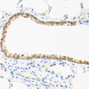Immunohistochemistry of paraffin-embedded Rat lung using CDKN2C Polyclonal Antibody at dilution of  1:100 (40x lens).