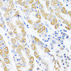 Immunohistochemistry of paraffin-embedded Human stomach using CDKN2C Polyclonal Antibody at dilution of  1:100 (40x lens).