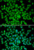 Immunofluorescence analysis of HeLa cells using CDKN2C Polyclonal Antibody