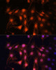 Immunofluorescence analysis of C6 cells using E2F1 Polyclonal Antibody at dilution of  1:100 (40x lens). Blue: DAPI for nuclear staining.