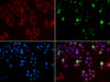 Immunofluorescence analysis of GFP-RNF168 transgenic U2OS cells using FANCD2 Polyclonal Antibody