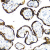 Immunohistochemistry of paraffin-embedded Human placenta using FGFR2 Polyclonal Antibody at dilution of  1:100 (40x lens).