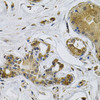 Immunohistochemistry of paraffin-embedded Human breast cancer using NCF4 Polyclonal Antibody at dilution of  1:100 (40x lens).