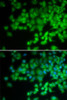 Immunofluorescence analysis of U2OS cells using NCF4 Polyclonal Antibody