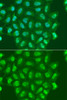 Immunofluorescence analysis of A549 cells using POLR2A Polyclonal Antibody