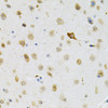 Immunohistochemistry of paraffin-embedded Mouse brain using SYK Polyclonal Antibody at dilution of  1:100 (40x lens).