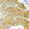 Immunohistochemistry of paraffin-embedded Human stomach using SYK Polyclonal Antibody at dilution of  1:100 (40x lens).