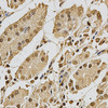 Immunohistochemistry of paraffin-embedded Human stomach using XRCC3 Polyclonal Antibody at dilution of  1:200 (40x lens).