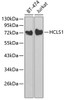Western blot analysis of extracts of various cell lines using HCLS1 Polyclonal Antibody at dilution of 1:1000.