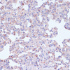 Immunohistochemistry of paraffin-embedded Rat lung using CD18 Polyclonal Antibody at dilution of  1:100 (40x lens).