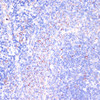 Immunohistochemistry of paraffin-embedded Rat spleen using CD18 Polyclonal Antibody at dilution of  1:100 (40x lens).