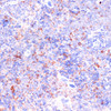 Immunohistochemistry of paraffin-embedded Mouse spleen using CD18 Polyclonal Antibody at dilution of  1:100 (40x lens).
