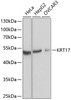 Western blot analysis of extracts of various cell lines using KRT17 Polyclonal Antibody at dilution of 1:1000.