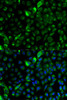 Immunofluorescence analysis of A-549 cells using KRT17 Polyclonal Antibody