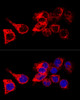 Confocal immunofluorescence analysis of HeLa cells using KRT17 Polyclonal Antibody at dilution of  1:200. Blue: DAPI for nuclear staining.