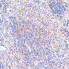Immunohistochemistry of paraffin-embedded Rat spleen using PDGFR beta Polyclonal Antibody at dilution of  1:100 (40x lens).