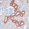 Immunohistochemistry of paraffin-embedded Rat kidney using PDGFR beta Polyclonal Antibody at dilution of  1:100 (40x lens).
