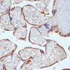 Immunohistochemistry of paraffin-embedded Human placenta using PDGFR beta Polyclonal Antibody at dilution of  1:100 (40x lens).
