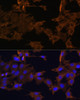 Immunofluorescence analysis of C6 cells using PDGFR beta Polyclonal Antibody at dilution of  1:100. Blue: DAPI for nuclear staining.