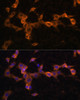 Immunofluorescence analysis of NIH/3T3 cells using PDGFR beta Polyclonal Antibody at dilution of  1:100. Blue: DAPI for nuclear staining.