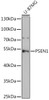 Western blot analysis of extracts of U-87MG cells using PSEN1 Polyclonal Antibody at dilution of 1:1000.