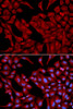 Immunofluorescence analysis of U2OS cells using DCTN2 Polyclonal Antibody
