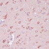 Immunohistochemistry of paraffin-embedded Rat brain using TOLLIP Polyclonal Antibody at dilution of  1:100 (40x lens).