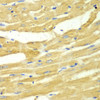 Immunohistochemistry of paraffin-embedded Rat heart using OGT Polyclonal Antibody at dilution of  1:100 (40x lens).