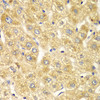 Immunohistochemistry of paraffin-embedded Human liver damage using OGT Polyclonal Antibody at dilution of  1:100 (40x lens).