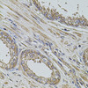 Immunohistochemistry of paraffin-embedded Human prostate using ALIX / PDCD6IP Polyclonal Antibody at dilution of  1:100 (40x lens).