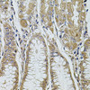 Immunohistochemistry of paraffin-embedded Human stomach using ALIX / PDCD6IP Polyclonal Antibody at dilution of  1:100 (40x lens).