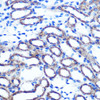 Immunohistochemistry of paraffin-embedded Mouse kidney using TSG101 Polyclonal Antibody at dilution of  1:100 (40x lens).