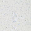 Immunohistochemistry of paraffin-embedded Rat liver using KAT2A Polyclonal Antibody at dilution of  1:100 (40x lens).
