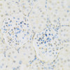 Immunohistochemistry of paraffin-embedded Rat kidney using KAT2A Polyclonal Antibody at dilution of  1:100 (40x lens).