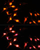 Immunofluorescence analysis of C6 cells using KAT2A Polyclonal Antibody at dilution of  1:100 (40x lens). Blue: DAPI for nuclear staining.