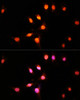 Immunofluorescence analysis of U-2 OS cells using KAT2A Polyclonal Antibody at dilution of  1:100 (40x lens). Blue: DAPI for nuclear staining.