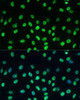 Immunofluorescence analysis of C6 cells using TRIM28 Polyclonal Antibody at dilution of  1:100 (40x lens). Blue: DAPI for nuclear staining.