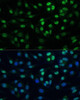 Immunofluorescence analysis of L929 cells using TRIM28 Polyclonal Antibody at dilution of  1:100 (40x lens). Blue: DAPI for nuclear staining.
