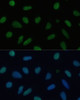 Immunofluorescence analysis of U-2 OS cells using TRIM28 Polyclonal Antibody at dilution of  1:100 (40x lens). Blue: DAPI for nuclear staining.