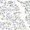 Immunohistochemistry of paraffin-embedded Human stomach using CBX1 Polyclonal Antibody at dilution of  1:100 (40x lens).
