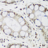 Immunohistochemistry of paraffin-embedded Human gastric using CBX3 Polyclonal Antibody at dilution of  1:200 (40x lens).