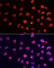 Immunofluorescence analysis of HeLa cells using DiMethyl-Histone H3-K4 Polyclonal Antibody at dilution of  1:100. Blue: DAPI for nuclear staining.
